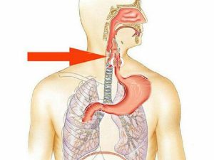 20210823_ung-thu-thuc-quan--nguyen-nhan