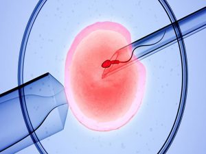 3D rendering of the icsi(intracytoplasmic sperm injection) process - in which a single sperm is injected directly into an egg