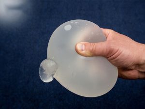 chan-doan-vo-tui-nguc