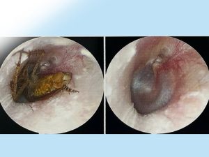 hinh-anh-gian-chui-vo-tai