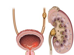 noi-soi-tan-soi-nieu-quan